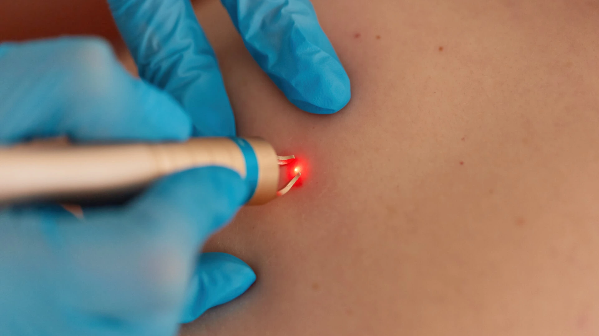 Cirurgia Dermatológica 01