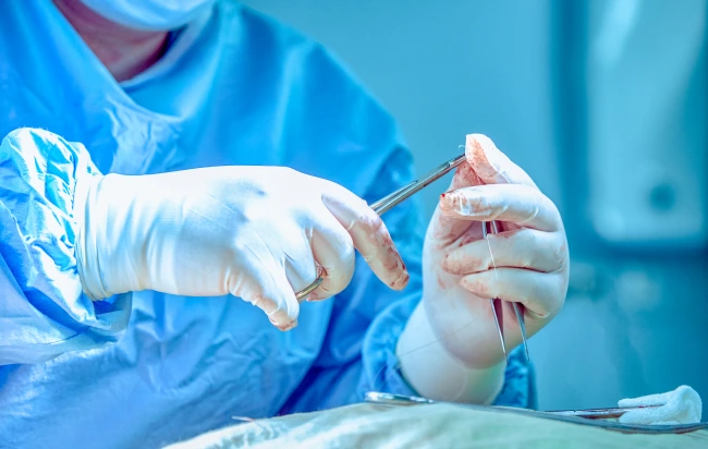 Cirurgia Micrográfica de Mohs