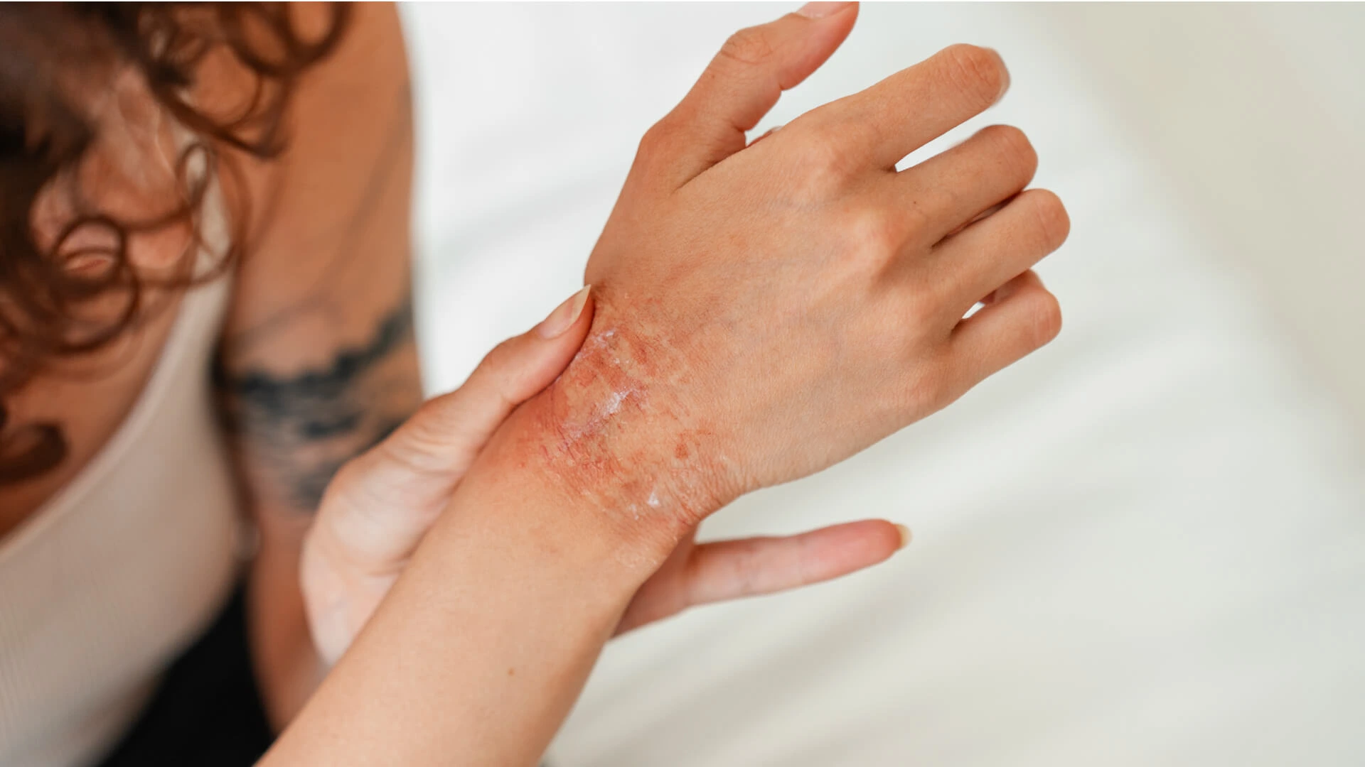 Dermatologia Clínica 02