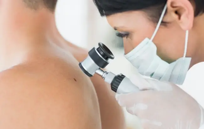 Dermatoscopia